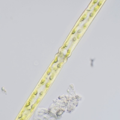 Pleurotaenium trabecula (Green Freshwater Algae) at Paddys River, ACT - 6 Dec 2016 by KenT