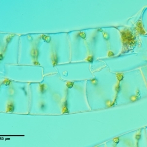 Spirogyra sp. at Cotter River, ACT - 5 Jan 2017 09:21 AM