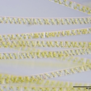 Spirogyra sp. at Coree, ACT - 20 Nov 2018 08:40 AM