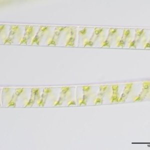 Spirogyra sp. at Coree, ACT - 20 Nov 2018 08:40 AM