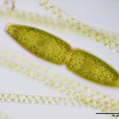 Pleurotaenium truncatum (A desmid freshwater algae) at Coree, ACT - 19 Nov 2018 by KenT
