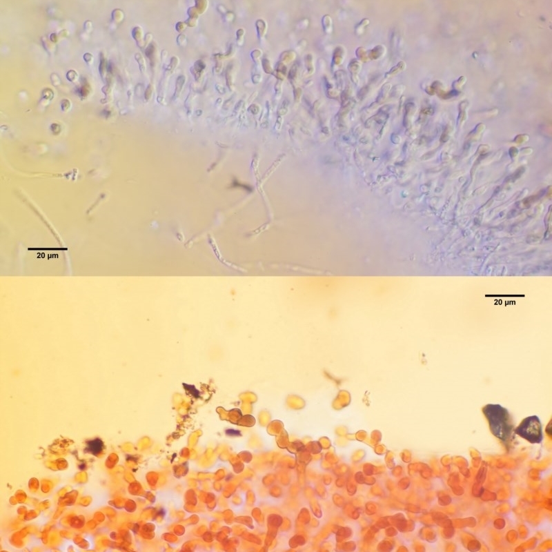 Tremella foliacea group