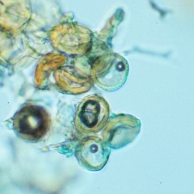 Uromycladium tepperianum s.lat.