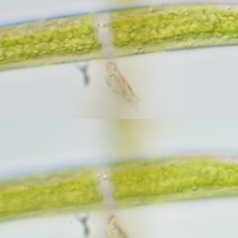 Closterium ehrenbergii