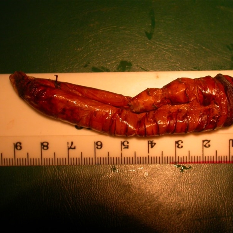 Hepialidae (family)